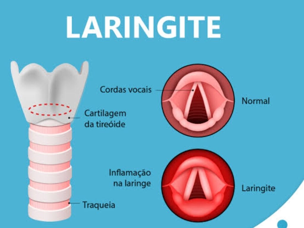 Vacinação e biosseguridade são estratégias para frear o avanço da Laringotraqueíte Aviária no Brasil