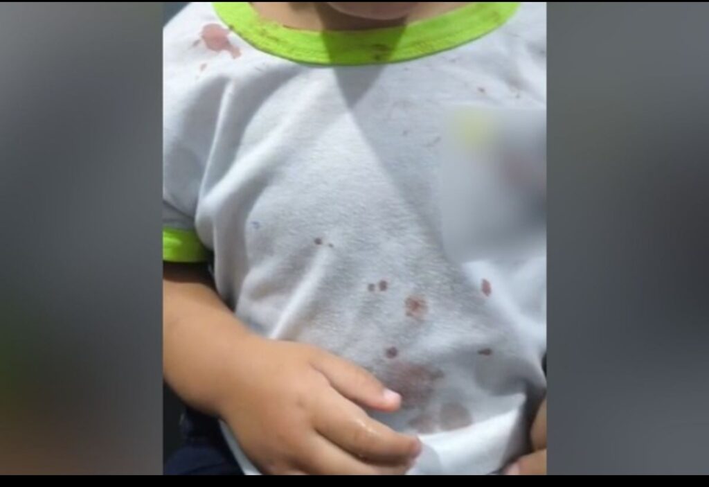 Funcionários de creche identificam hematomas e manchas de sangue em menina de 2 anos; padrasto é preso no Paraná